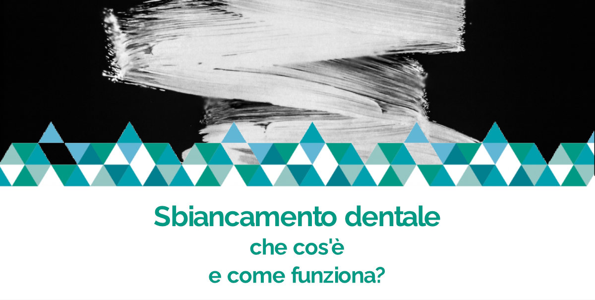 sbiancamento dentale